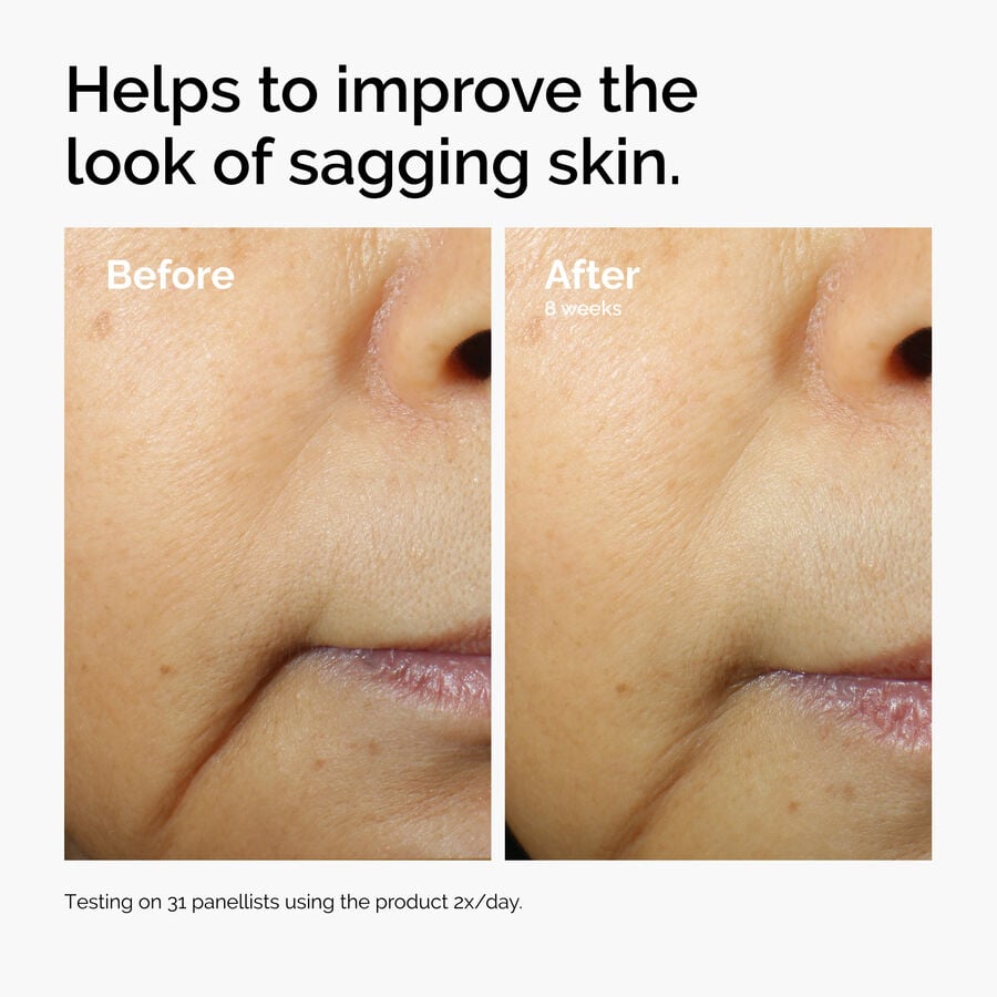 caffeine-3-escin-1-face-serum-r0 ord-caffeine-3pct-escin-1pct-face-serum-before-after-sagging.jpg