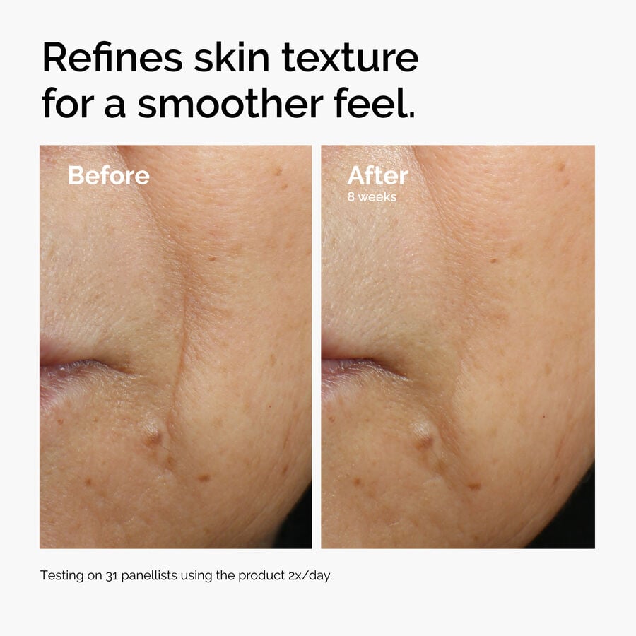 caffeine-3-escin-1-face-serum-r0 ord-caffeine-3pct-escin-1pct-face-serum-before-after-texture.jpg