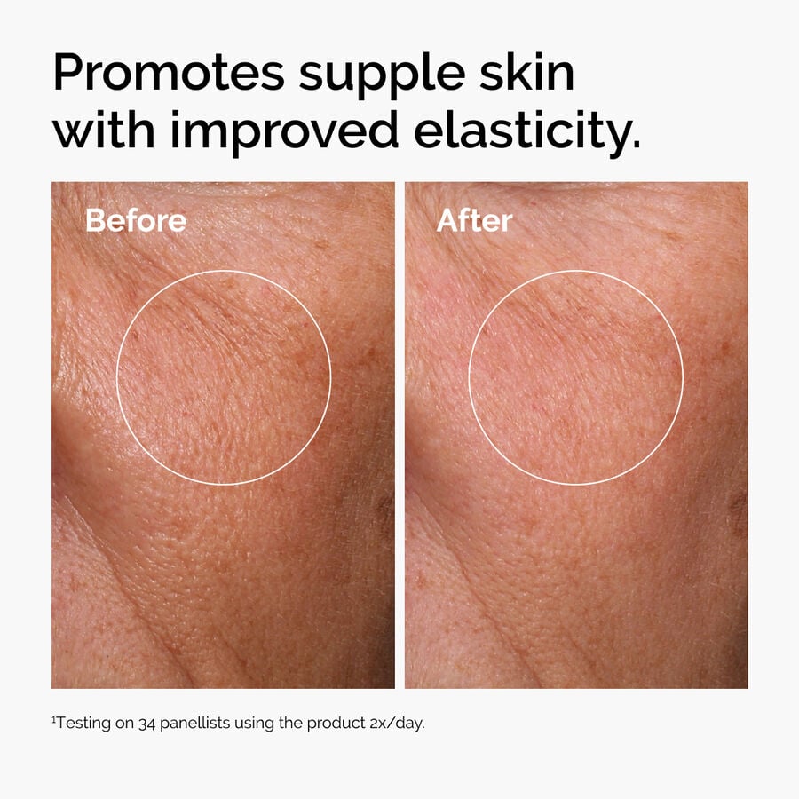 hyaluronic-acid-2-b5-with-ceramides-d0 ord-hyaluronic-acid-2pct-b5-hydrating-serum-before-after-elasticity.jpg
