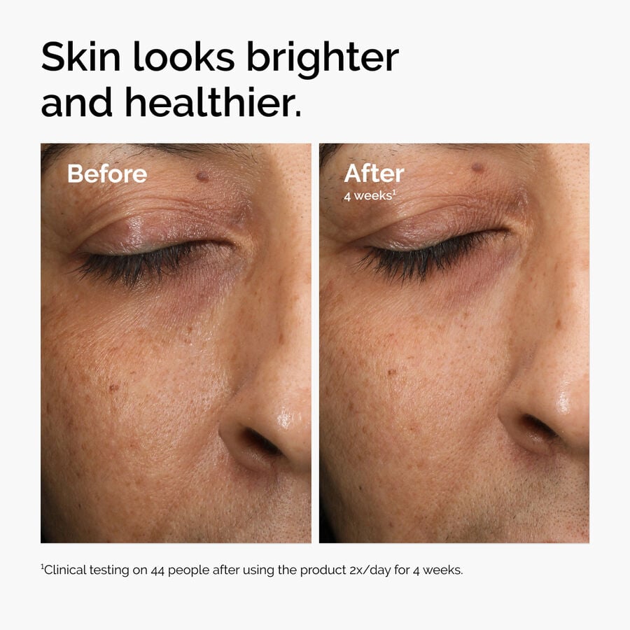 multi-antioxidant-radiance-serum-b9 ord-mars-before-after-healthy.jpg