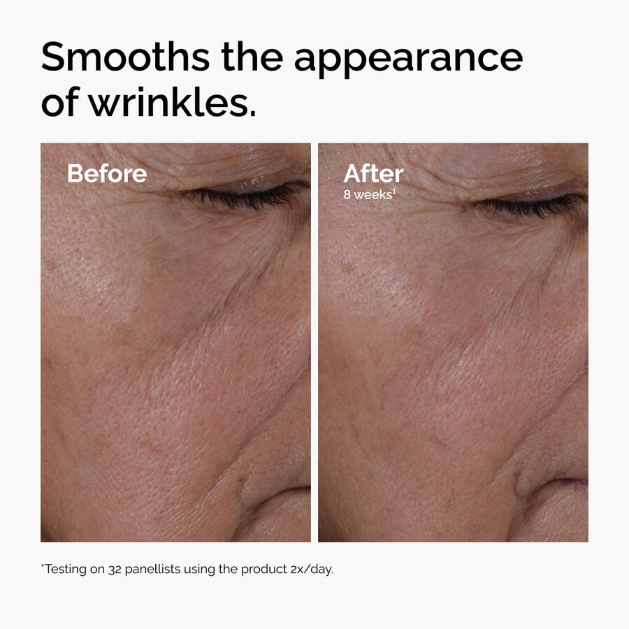 multi-peptide-ha-serum-v2 ord-multi-peptide-ha-serum-wrinkles-before-after.jpg
